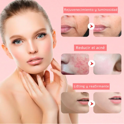 Masajeador Facial LedTerapia + Regalo Masajeador 3D